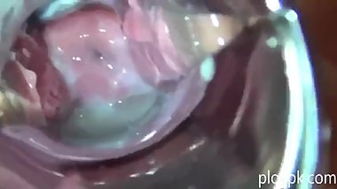 20190427-SC05 creampie pussy observation using speculum